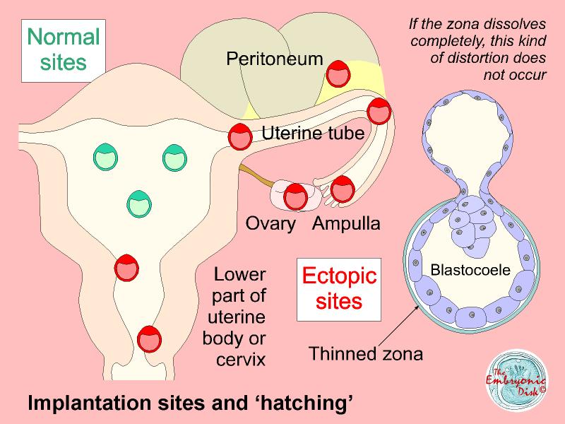 Implantation