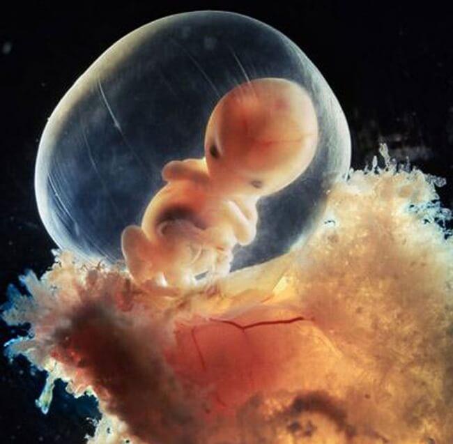 Έμβρυο 9 Εβδομάδων Η βασική οργανογένεση έχει ολοκληρωθεί Έχουν σχηματιστεί ο οφθαλμικές κόγχες και οι αρχέγονοι οφθαλμοί Παράγονται μεγάλες