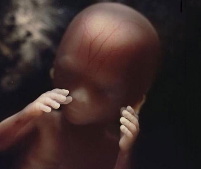 (σύλληψη, ψηλάφηση) Μέγεθος 4 εκατοστά Έμβρυο 16 Εβδομάδων Ο σχηματισμός των έξω γεννητικών οργάνων έχει ολοκληρωθεί Τα