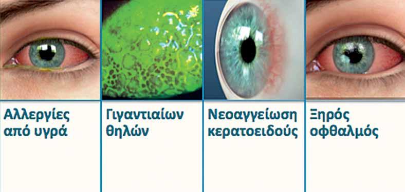διαθλαστική χειρουργική Εικόνα 5.