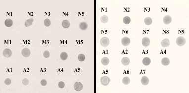 Ανίχνευση κυτταροκινών σε σίελο και ορό TNFα Μεταβολή Δείγμα Είδος πληθυσμού Αριθμός δειγμάτων OD κηλίδας Dot Blot Ελάχιστο/μέγιστο Ανοσοσήμα Τυπική απόκλιση σε σχέση με control (%) Σίελος Ορός
