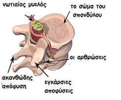 Σπονδυλική Στήλη (ΣΣ) Ο Σπόνδυλος