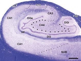 CA1: δύο στοιβάδες μικρών πυραμοειδών κυττάρων, CA2 : στενή στοιβάδα μεγάλων πυραμοειδών κυττάρων, CA3 χαλαρή στοιβάδα