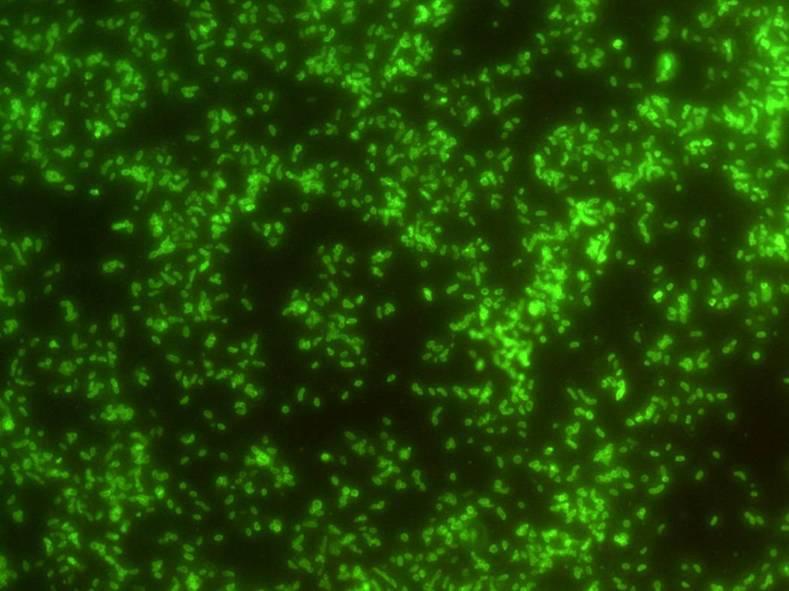 sur.15. V. cholerae O1 serotipis dadebiti DFA nimusi.