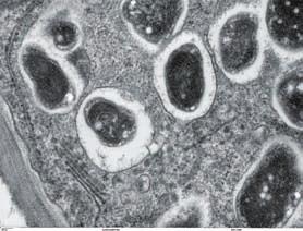 UR-8 Cards 21 22 Bradyrhizobium Monera (Bacteria) Proteobacteria