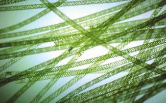 japonicum Bradyrhizobium japonicum Spirogyra Protista Charophyta