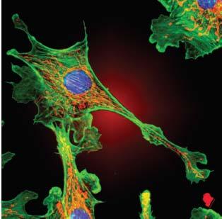 Φθορίζοντες δείκτες επιτρέπουν την παρατήρηση συγκεκριμένων πρωτεϊνών μέσα στα κύτταρα Τα κύτταρα είναι δυνατόν να χρωματιστούν με αντισώματα που φθορίζουν και να αναλυθούν με μικροσκοπία φθορισμού