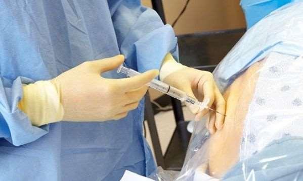 Αναγνώριση του επισκληρίδιου χώρου Η αναγνώριση του επισκληρίδιου χώρου γίνεται με τη μέθοδο της «απώλειας της αντίστασης» Γίνεται τοπική αναισθησία στο δέρμα και το υποδόριο.