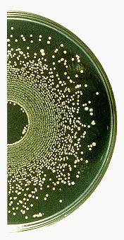 Α. Κλασσικές μέθοδοι Spiral plate Με τη μέθοδο αυτή το όργανο διανέμει το υγρό εμβόλιο στην επιφάνεια ενός περιστρεφόμενου