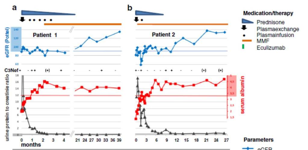 Πλασμαφαίρεση σε DDD/C3 glomerulopathy Απομάκρυνση παραγόντων του συμπληρώματος: C3Nef,