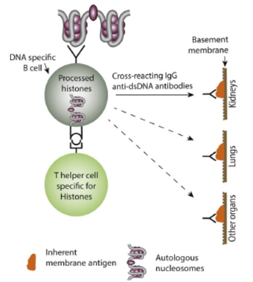 Παθογένεια της Νεφρίτιδας του ΣΕΛ: Δημιουργία Ανοσυμπλεγμάτων Type II ανοσολογική αντίδραση Δημιουργία αντισωμάτων έναντι τμημάτων του DNA
