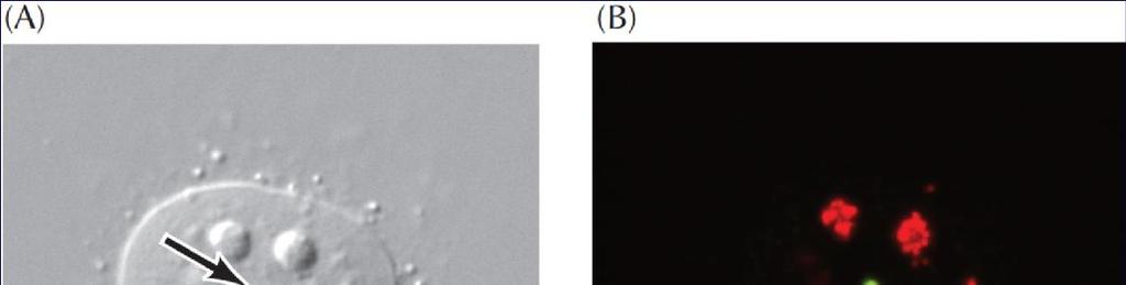 Τα σωμάτια Cajal μεγέθους 0.2-1 (έως 2) μm περιέχουν τη χαρακτηριστική πρωτεΐνη κοϊλίνη (p80 coilin) και πλήθος μικρών RNP.