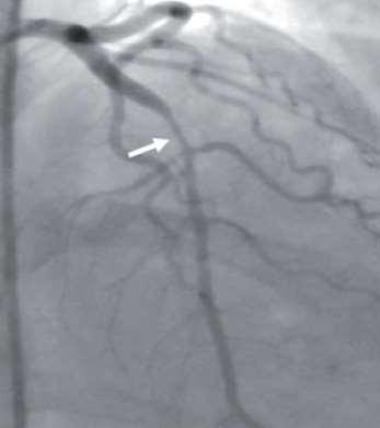 Cardiovasc Interv