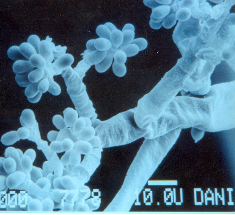Εικ. 56: Κονιδιοφόρος με κονίδια του Botrytis cinerea από ηλεκτρονικό μικροσκόπιο. Εικ. 57: Κονιδιοφόρος με κονίδια του βοτρύτη από απλό μικροσκόπιο.
