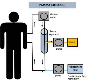 Therapeutic plasma exchange (TPE) Θεραπευτική ανταλλαγή πλάσματος Η θεραπευτική διαδικασία κατά την οποία το