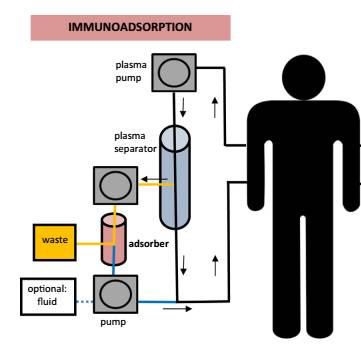 ΑΝΟΣΟΠΡΟΣΡΟΦΗΣΗ Immunoadsorption (IA) Η θεραπευτική διαδικασία κατά την οποία πλάσμα του ασθενούς, αφού διαχωριστεί από το αίμα, περνάει μέσα από ιατρική συσκευή η οποία έχει τη δυνατότητα να