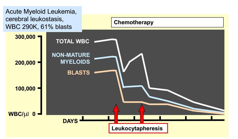 κρυσταλλοειδή. Η διαδικασία μπορεί να χρησιμοποιηθεί θεραπευτικά ή στη προετοιμασία συστατικών του αίματος. Hyperleukocytosis in acute myelogenous leukemia Ward DM.
