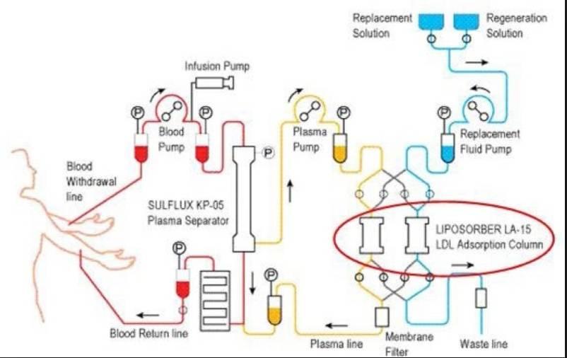 Προσρόφηση apob100 Αντισώματα 2-3h 3-6lt