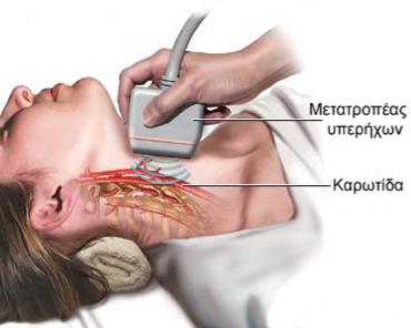 Σχήμα 1.5: Λήψη εικόνων υπερήχων στην κοινή καρωτίδα. κού τοιχώματος της καρωτίδας.