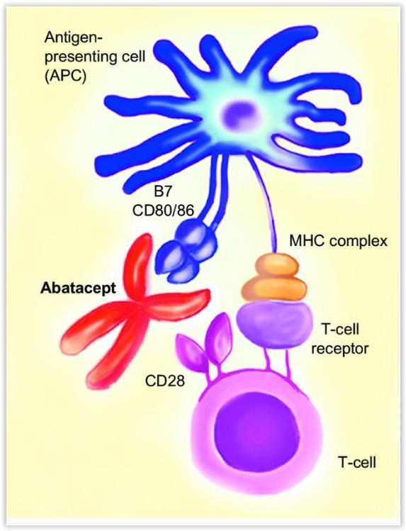Αναστολέας της συνδιέγερσης του Τ- κυττάρου CTLA-4Ig,