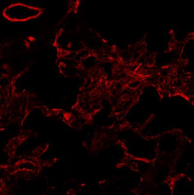 15. ILK: πράσινο, α-sma: κόκκινο, DAPI: μπλε.