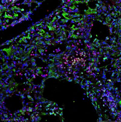 DAPI: μπλε.
