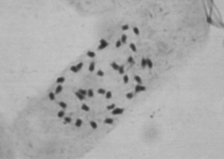 Eriotheca