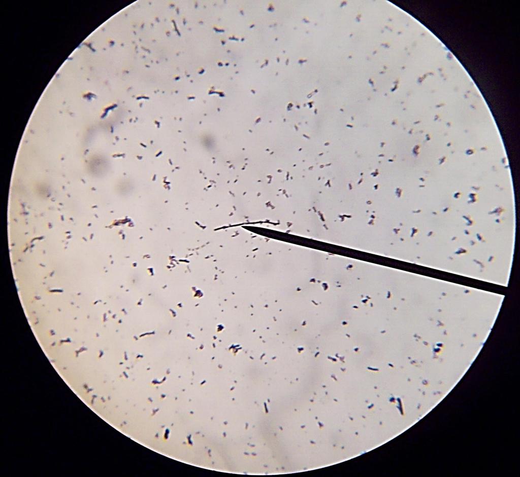 Εscherichia coli Γαλακτοβάκιλοι σε αλυσίδα κόκκοι