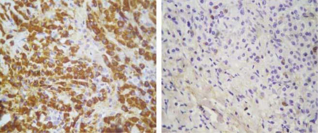 γa, 210bp TCRG γb, 188bp ΑΙΧ, κ
