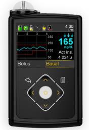 Continuous Glucose Monitoring