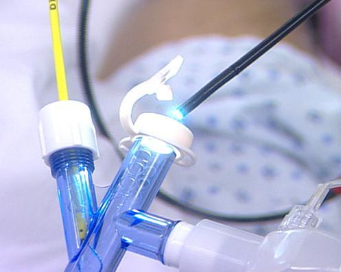 στερεώνεται στο περιφερικό άκρο