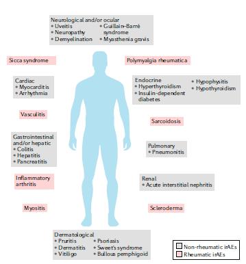 Ρευματολογικές εκδηλώσεις που σχετίζονται με τη χρήση ICI Επιδημολογία Όχι γνωστή Δεν καταγράφονται Μπορεί να εμφανιστούν ακόμα και 2 χρόνια