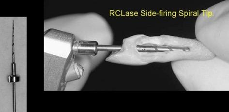 A Stabholz The role of laser technology in