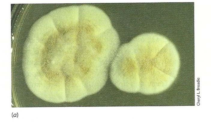 Σχ.280. Μύκητες με υφές (μούχλες). (α) Aspergillus (ασκομύκητας) που αναπτύσσεται σε τρυβλίο agar. (β) Κονιδιοφόρος και κονίδια Aspergillus fumigatus.