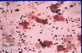 Streptoccocus Group B (agalactiae) Gram