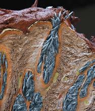 ΞΈΝΗ ΔΗΜΟΣΊΕΥΣΗ Demodex Μια γνωστή οντότητα, μια άγνωστη απειλή Η ιατρική και φαρμακευτική έρευνα στρέφει το ενδιαφέρον της στο παράσιτο Η οντότητα και η δραστηριότητα του ακάρεος Demodex αποτελούν
