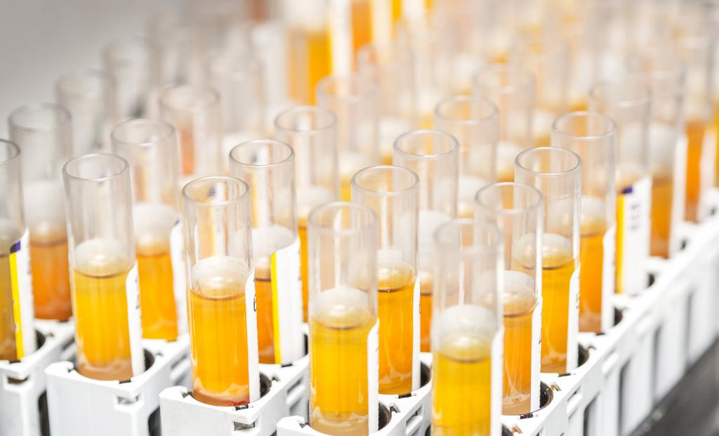 Ευρωπαϊκή Επιτροπή Ενημερωτικό δελτίο για Κατασκευαστές in vitro διαγνωστικών ιατροτεχνολογικών προϊόντων Το παρόν ενημερωτικό δελτίο προορίζεται για τους κατασκευαστές in vitro διαγνωστικών