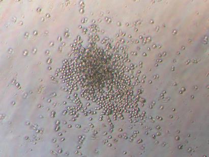 CFUs assays from the placental perfusion. A.