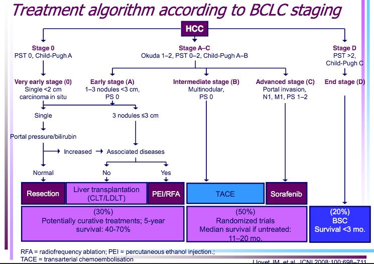 Figure 2. The BCLC staging system for HCC (M: metastasis classification. N: node classification.
