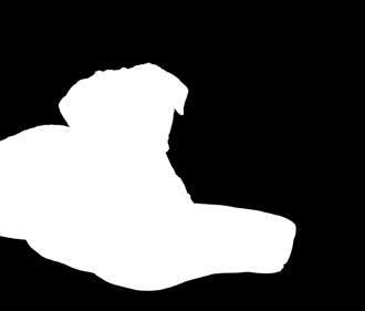 However there are orthopaedic conditions that cause lack of limb coordination and increase in joint flexion and extension range of motion compared to the normal.