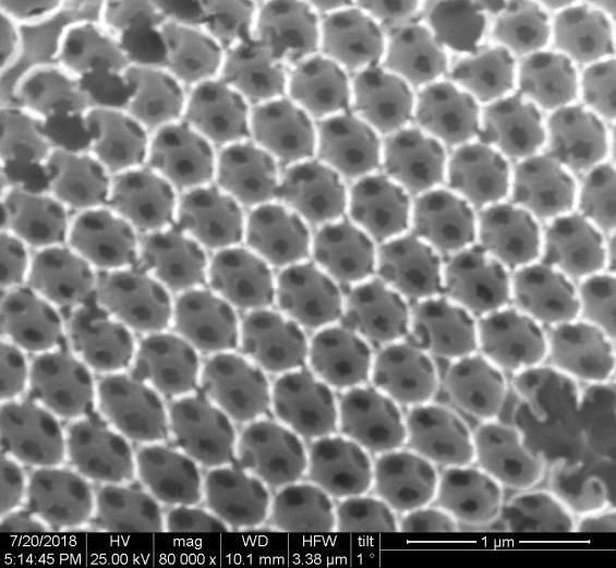 transmission electron