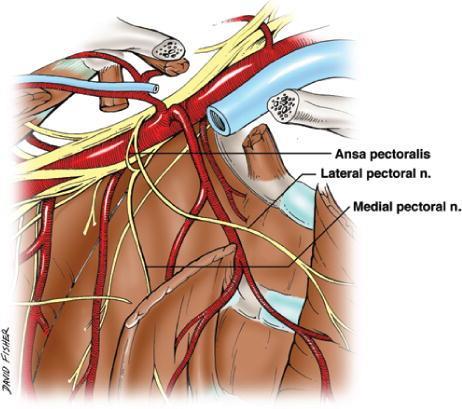 PECS 1,2 SAP block-χειρουργική ανατομία Ενδιαφέρον παρουσιάζει η χειρουργική ανατομία των θωρακικών νεύρων.