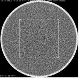 Θόρυβος N 1 ROI NPS ( f, f ) FT { ROI ( x,