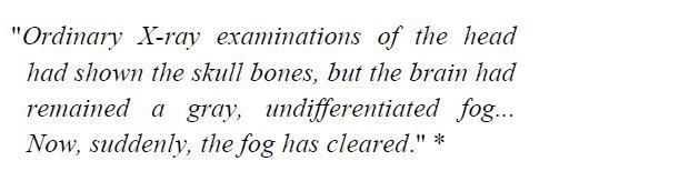 * From Nobel committee s presentation speech at
