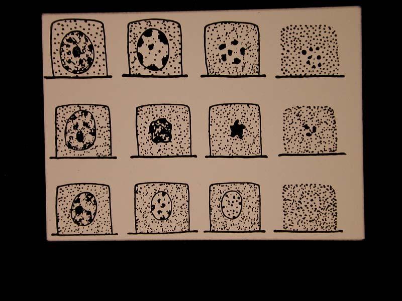 Χαρακτηριστικά νεκρωτικών κυττάρων Τα κύρια χαρακτηριστικά της κυτταρικής