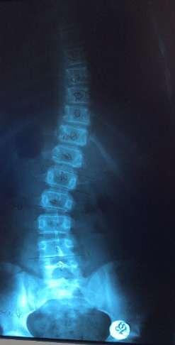 11/12 31