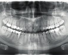 OP 3D Pro_ CBCT Ένα μηχάνημα για όλες τις ανάγκες σας με Low