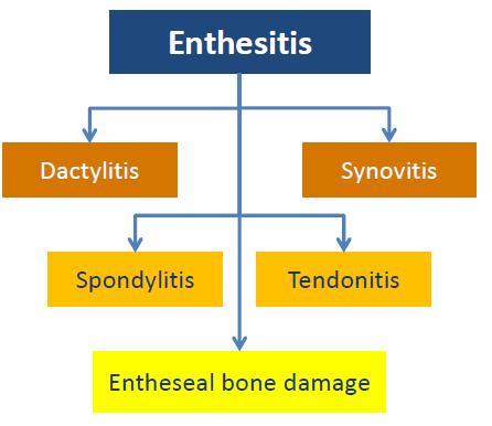 εξζλιξθ τθσ δομικισ βλάβθσ 1 *EULAR, European League Against Rheumatism; MRI, magnetic resonance