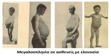 - 88 - Ιατρικά Χρονικά Βορειοδυτικής Ελλάδας - Τόμος 14ος - Τεύχος 1ο Η νοσηρότητα του ελληνικού πληθυσμού στα Επτάνησα (15ος -19ος αιώνας) - 89-3.