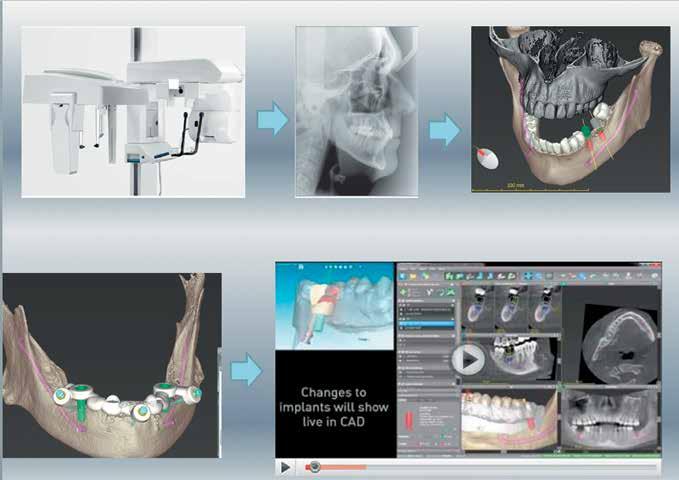 62 Dental Tribune Greek Edition DT σελίδα 61 αλλά υποδιέστερο μηχάνημα. Θα έλεγα ότι το VFM (Value for money) βρίσκεται πρακτικά στα 15-20 μm.